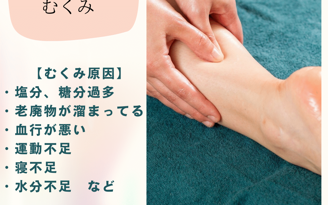 むくみの原因を知って解消しましょう！